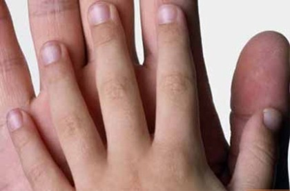 fingernails-child-hand